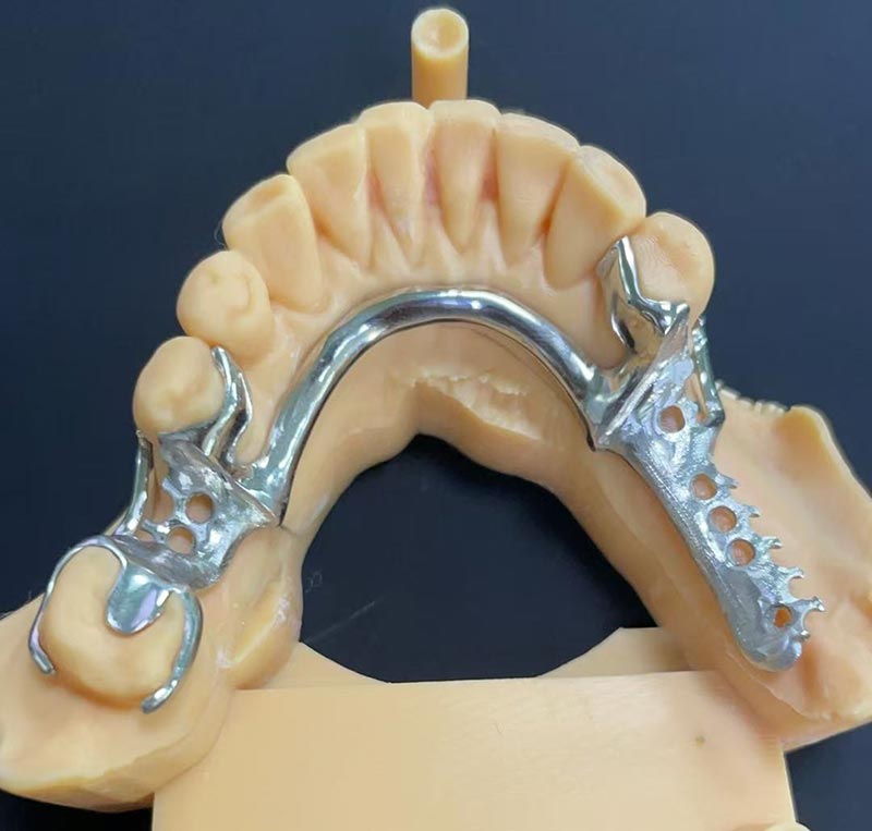 कोबाल्ट-क्रोमियम फ्रेमवर्क (सीओ सीआर फ्रेमवर्क) के लाभ