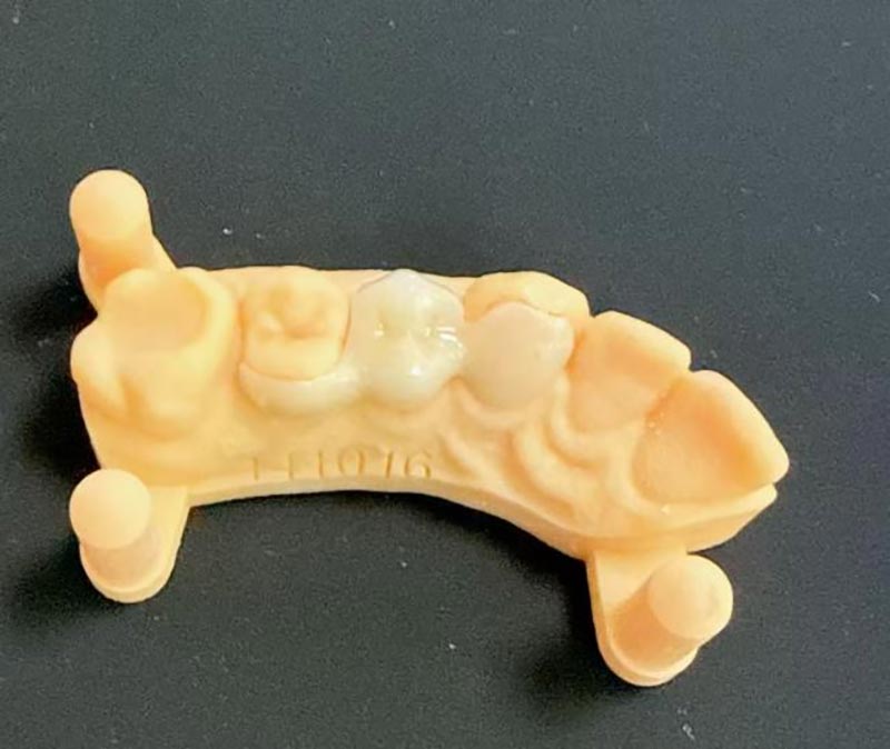 मैरीलैंड ब्रिज के बारे में आपको क्या जानना चाहिए?