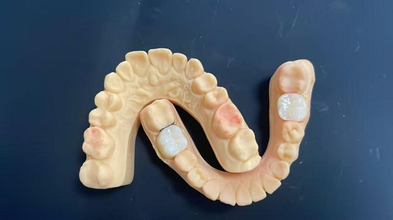 कंधे का किनारा क्या है?