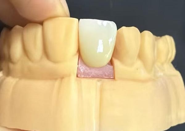 दांतों के बीच के गैप को ठीक किया जा सकता है—सीधे दांत सबसे आकर्षक होते हैं!