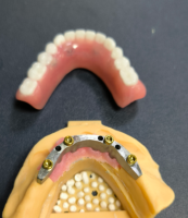 लोकेटर और डेंटल बार